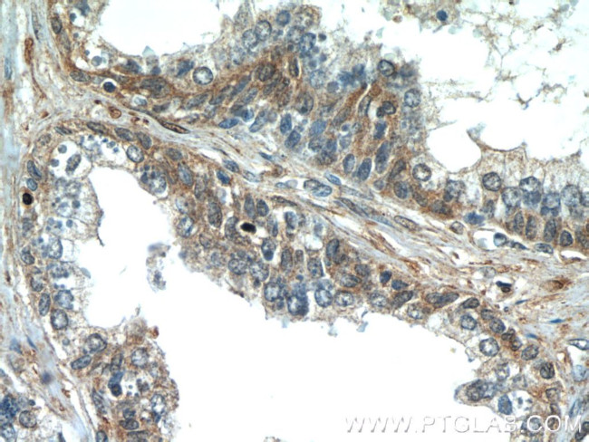 PAGE2 Antibody in Immunohistochemistry (Paraffin) (IHC (P))