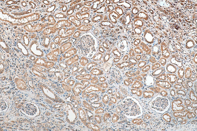 FXYD4 Antibody in Immunohistochemistry (Paraffin) (IHC (P))