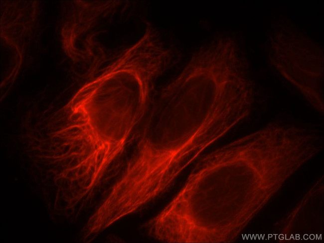 PPP1R2P9 Antibody in Immunocytochemistry (ICC/IF)