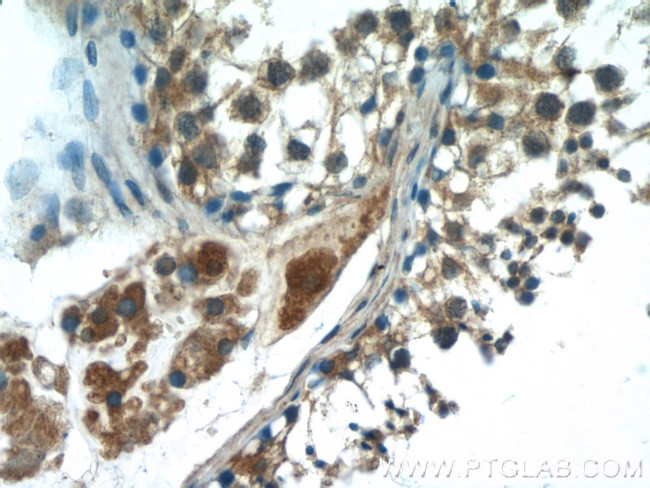HSFY1 Antibody in Immunohistochemistry (Paraffin) (IHC (P))