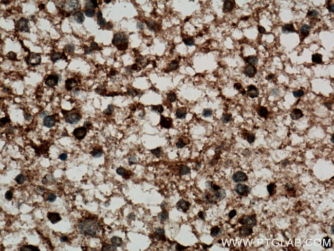 GDAP1L1 Antibody in Immunohistochemistry (Paraffin) (IHC (P))