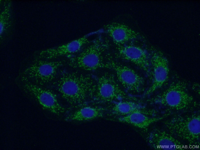 GNB4 Antibody in Immunocytochemistry (ICC/IF)