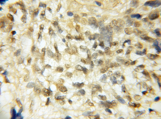 ROBO3 Antibody in Immunohistochemistry (Paraffin) (IHC (P))