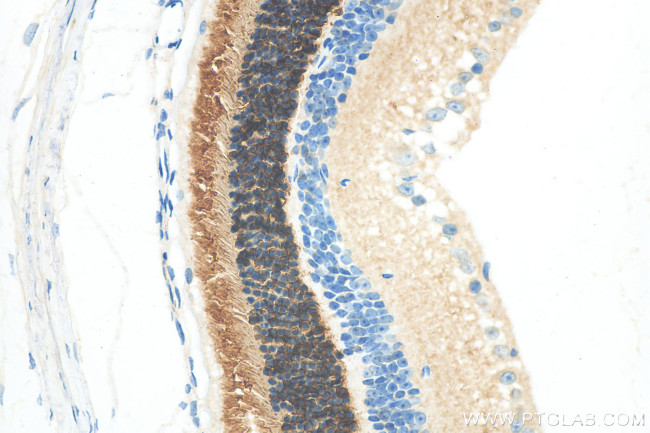 GNGT2 Antibody in Immunohistochemistry (Paraffin) (IHC (P))