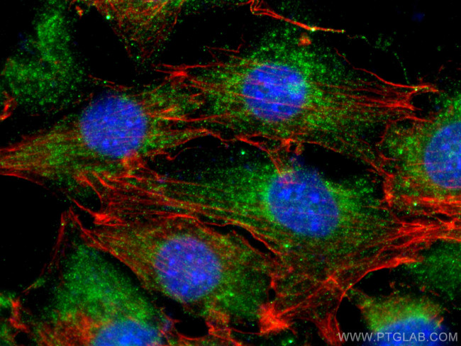 MLK3 Antibody in Immunocytochemistry (ICC/IF)
