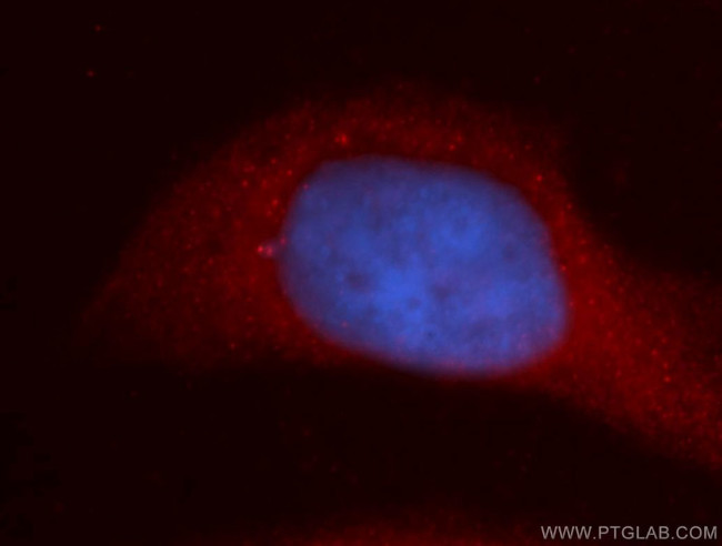 URG4 Antibody in Immunocytochemistry (ICC/IF)