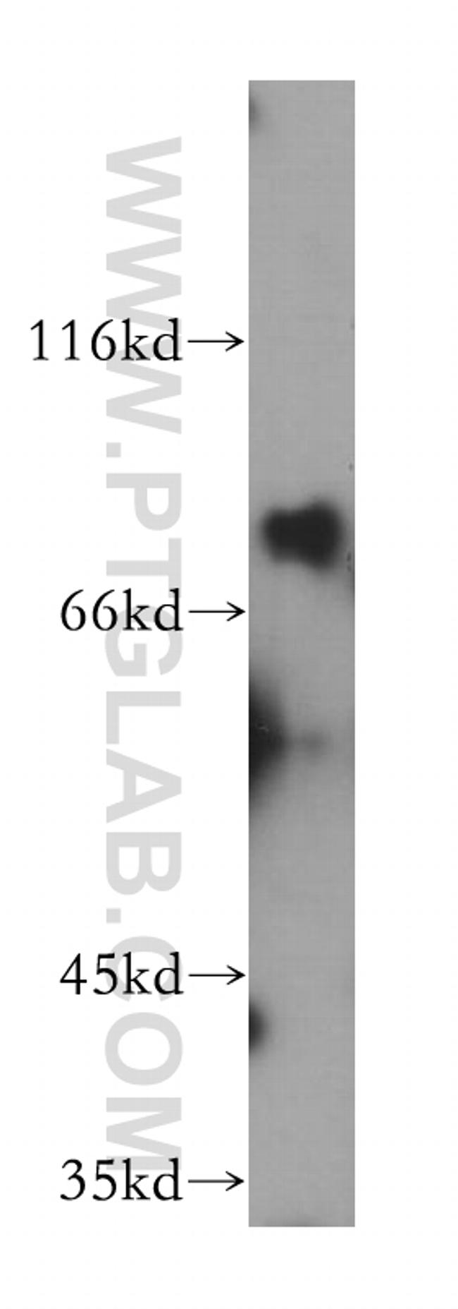 Dymeclin Antibody in Western Blot (WB)