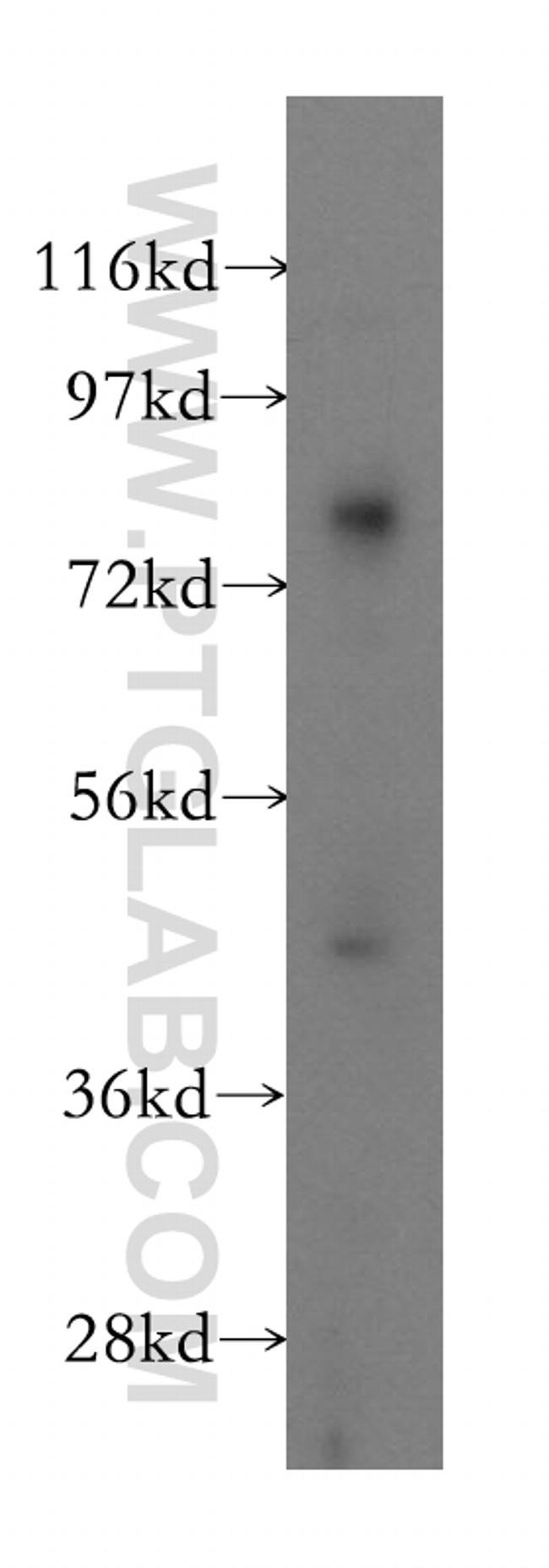 GGT5 Antibody in Western Blot (WB)