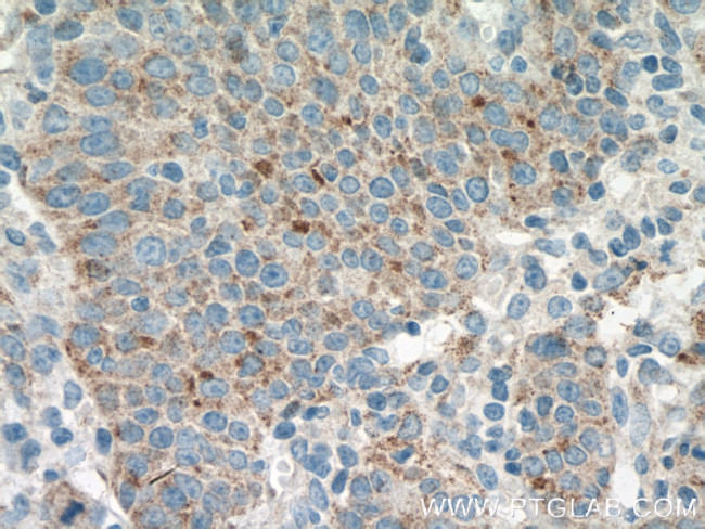 AVPI1 Antibody in Immunohistochemistry (Paraffin) (IHC (P))
