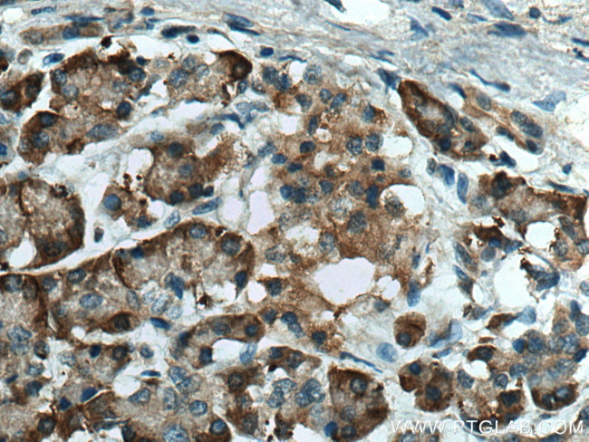 ERO1L Antibody in Immunohistochemistry (Paraffin) (IHC (P))