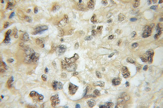 Exo70 Antibody in Immunohistochemistry (Paraffin) (IHC (P))