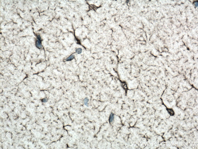 NDRG2 Antibody in Immunohistochemistry (Paraffin) (IHC (P))