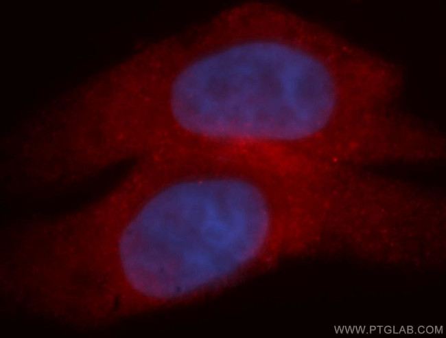 MYCBP Antibody in Immunocytochemistry (ICC/IF)