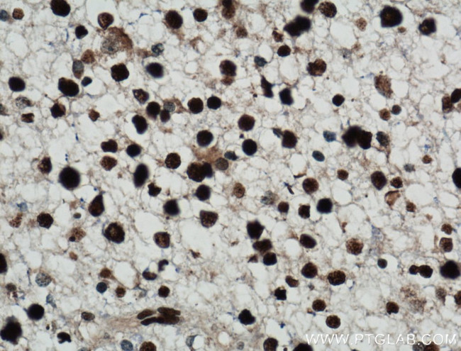 NUCKS1 Antibody in Immunohistochemistry (Paraffin) (IHC (P))