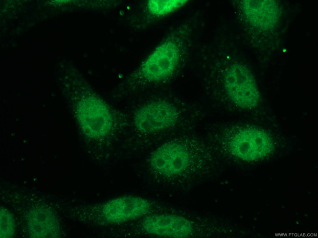 HOXC10 Antibody in Immunocytochemistry (ICC/IF)