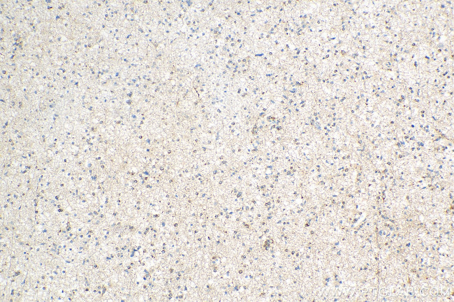 STMN4 Antibody in Immunohistochemistry (Paraffin) (IHC (P))