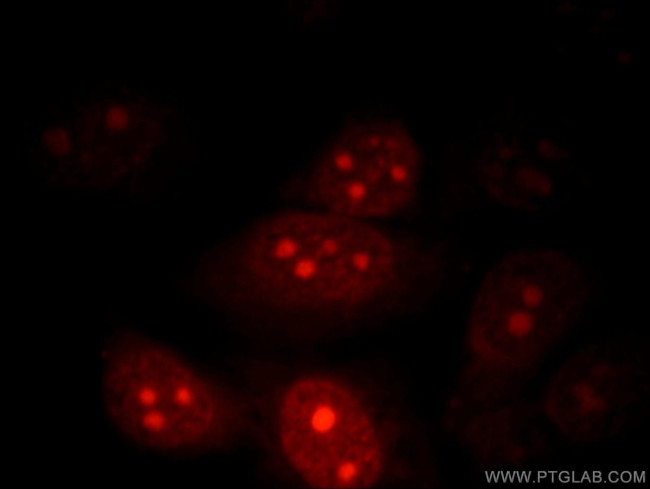 POP1 Antibody in Immunocytochemistry (ICC/IF)