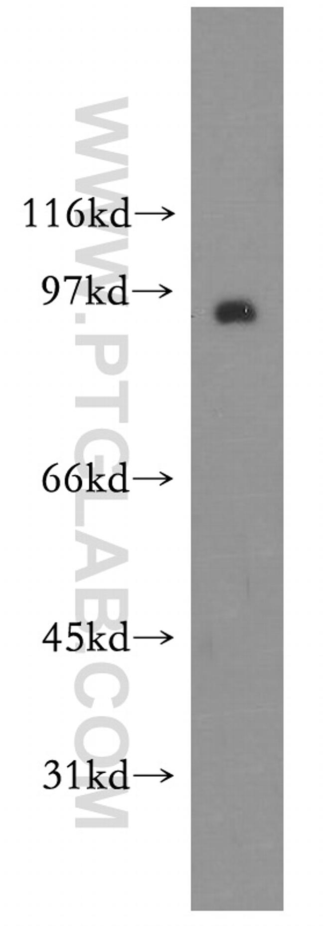 Synaptotagmin-11 Antibody in Western Blot (WB)