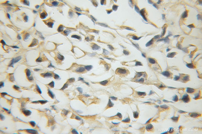 SLC38A1 Antibody in Immunohistochemistry (Paraffin) (IHC (P))