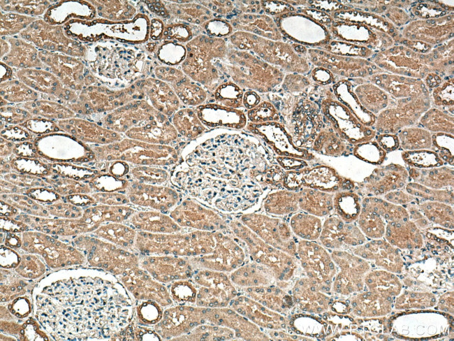 DISP1 Antibody in Immunohistochemistry (Paraffin) (IHC (P))