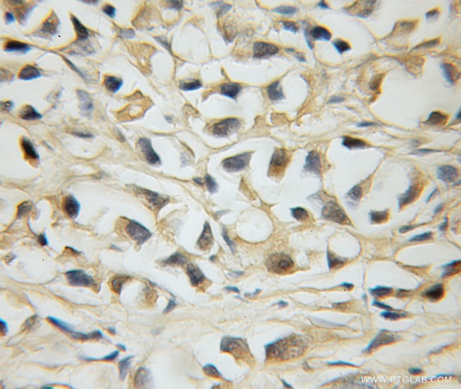 MLX Antibody in Immunohistochemistry (Paraffin) (IHC (P))