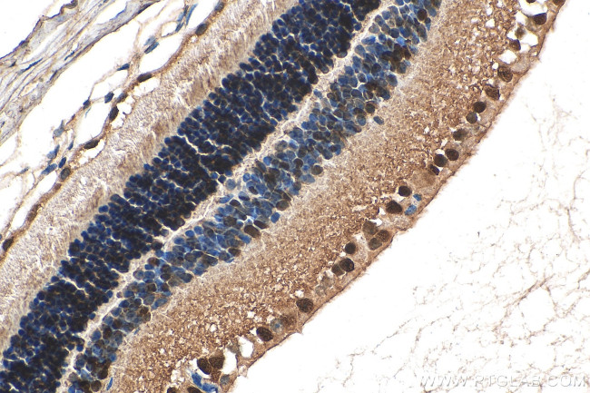 CRX Antibody in Immunohistochemistry (Paraffin) (IHC (P))