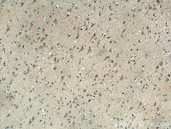 CHN1 Antibody in Immunohistochemistry (Paraffin) (IHC (P))