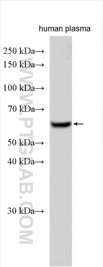 APBB3 Antibody in Western Blot (WB)
