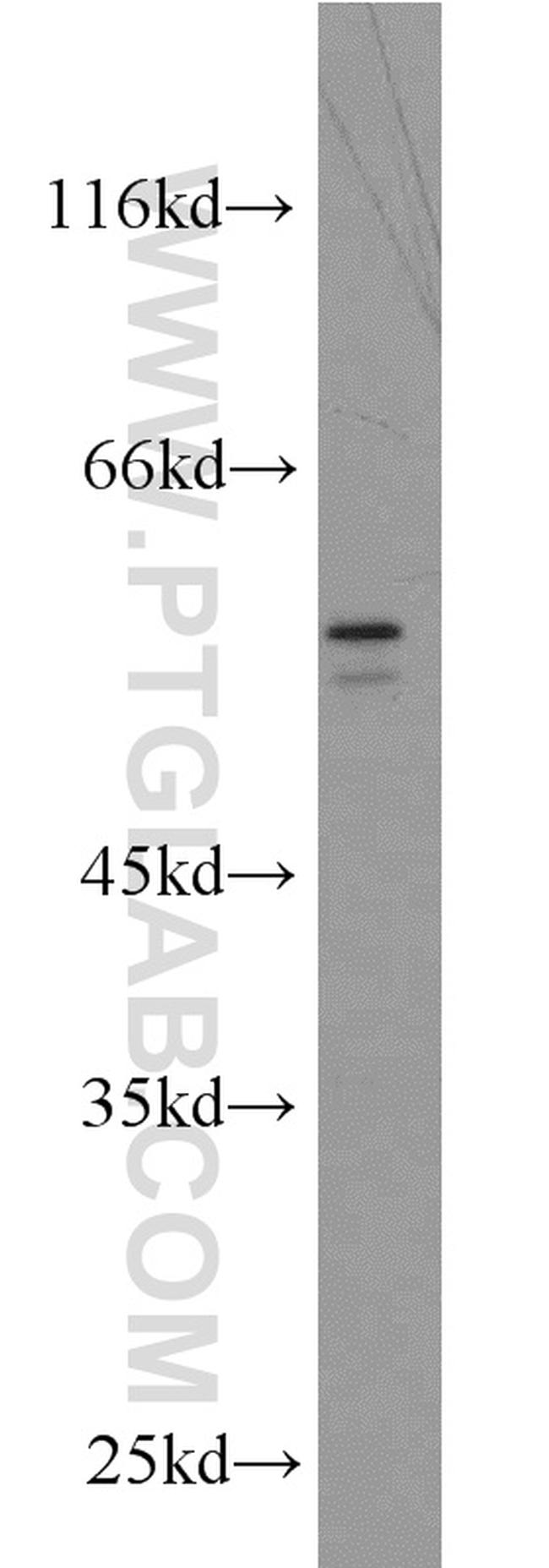 BRF2 Antibody in Western Blot (WB)