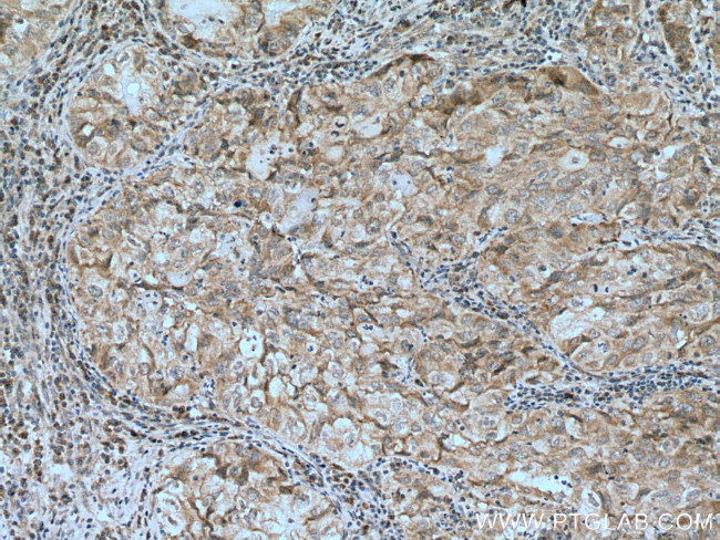 IP6K1 Antibody in Immunohistochemistry (Paraffin) (IHC (P))