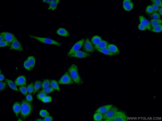 ODF2 Antibody in Immunocytochemistry (ICC/IF)
