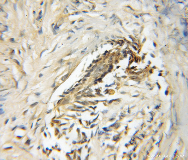 USP33 Antibody in Immunohistochemistry (Paraffin) (IHC (P))