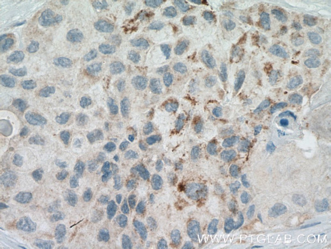 RARRES3 Antibody in Immunohistochemistry (Paraffin) (IHC (P))