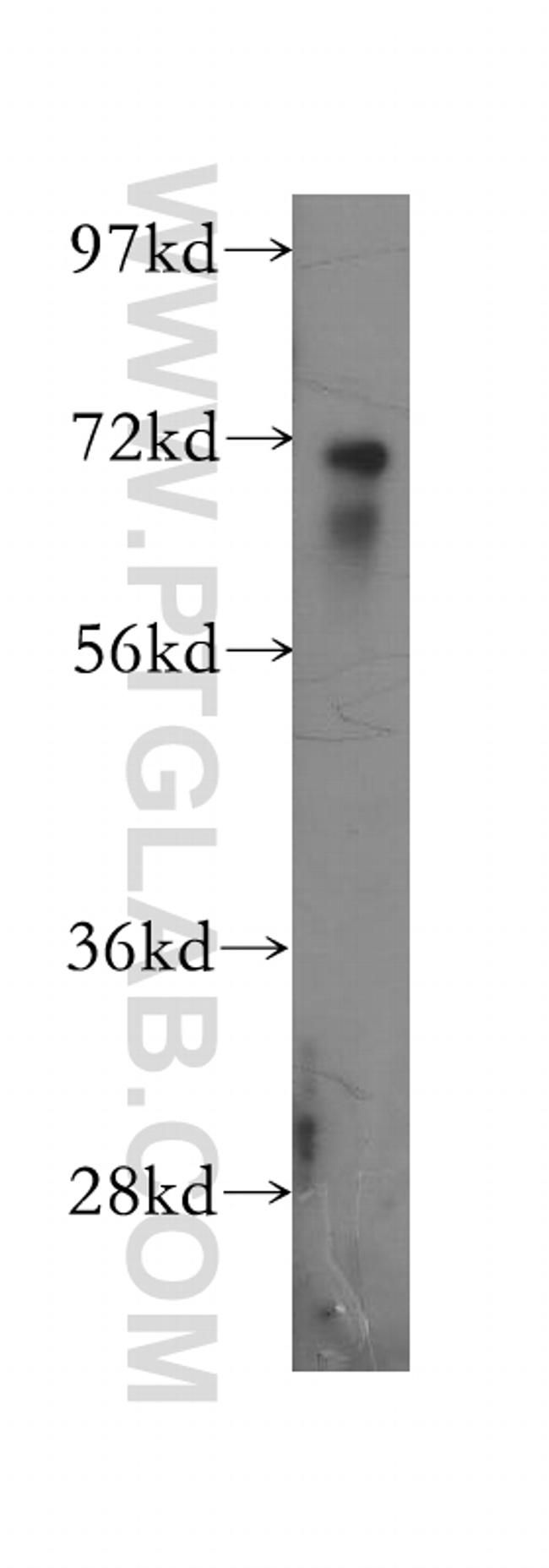 PPP2R5D Antibody in Western Blot (WB)