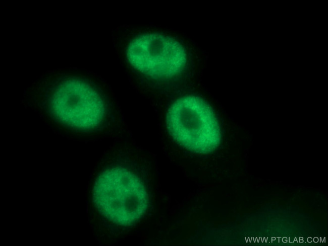 SF3A3 Antibody in Immunocytochemistry (ICC/IF)