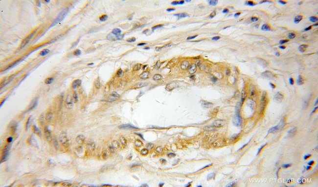 Cystatin F Antibody in Immunohistochemistry (Paraffin) (IHC (P))