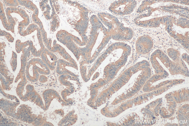 TRAPPC4 Antibody in Immunohistochemistry (Paraffin) (IHC (P))