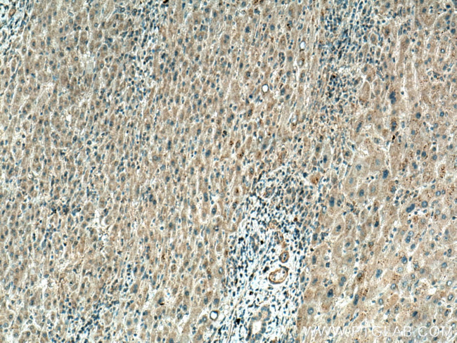 TINAGL1 Antibody in Immunohistochemistry (Paraffin) (IHC (P))