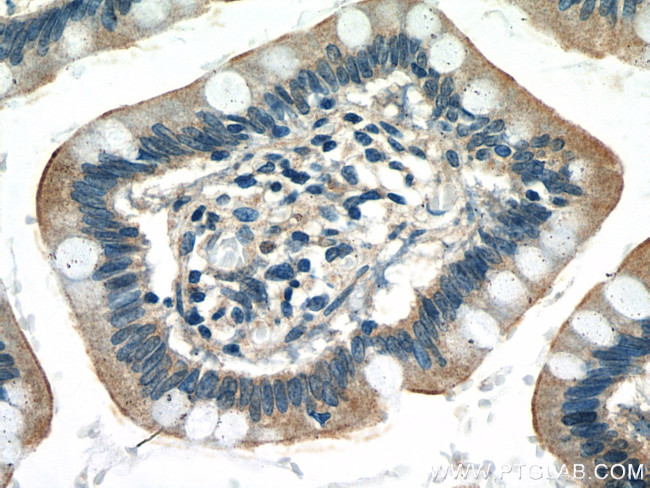 GNA15 Antibody in Immunohistochemistry (Paraffin) (IHC (P))