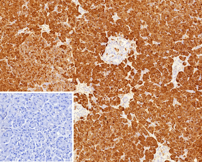 Colipase/CLPS Antibody in Immunohistochemistry (Paraffin) (IHC (P))