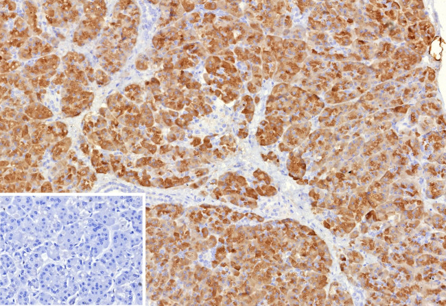 Colipase/CLPS Antibody in Immunohistochemistry (Paraffin) (IHC (P))
