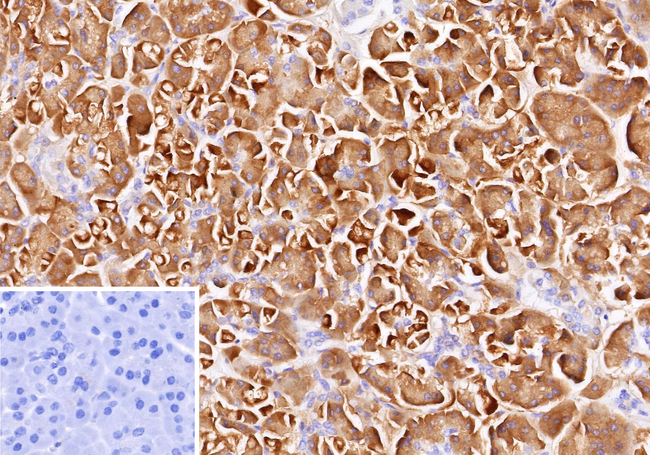 Colipase/CLPS Antibody in Immunohistochemistry (Paraffin) (IHC (P))