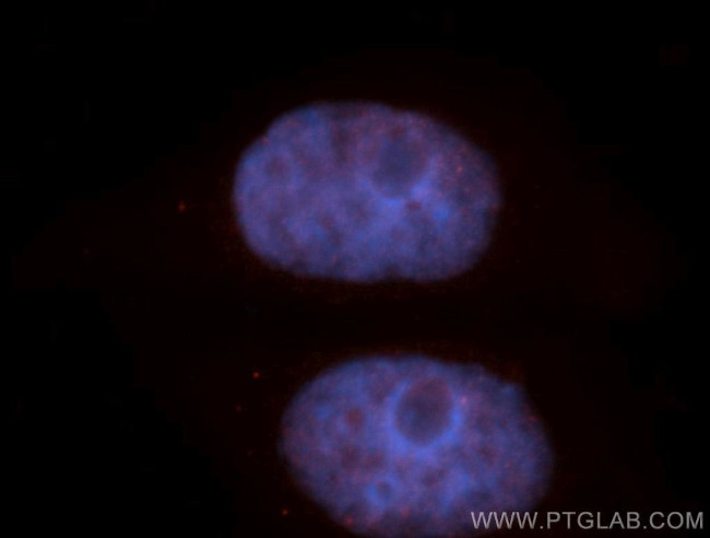HMG20A Antibody in Immunocytochemistry (ICC/IF)