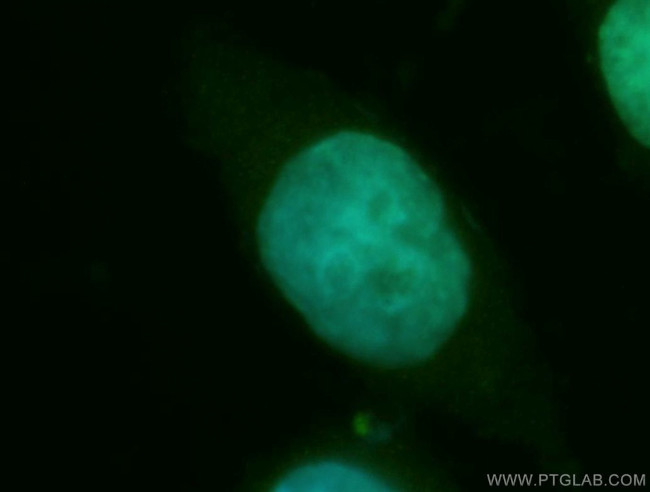 CDA1 Antibody in Immunocytochemistry (ICC/IF)