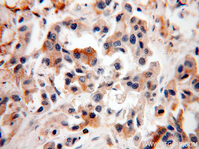 SRPR Antibody in Immunohistochemistry (Paraffin) (IHC (P))