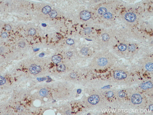 G0S2 Antibody in Immunohistochemistry (Paraffin) (IHC (P))