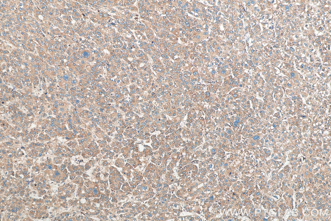 FKBP7 Antibody in Immunohistochemistry (Paraffin) (IHC (P))