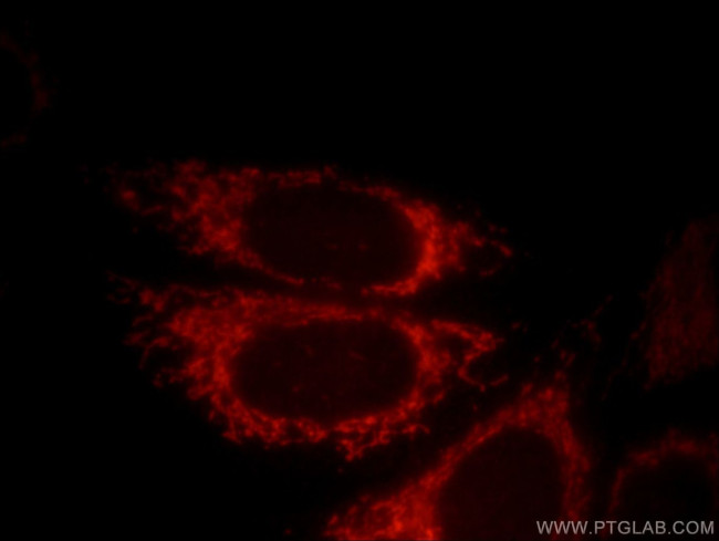 DNAJC19 Antibody in Immunocytochemistry (ICC/IF)