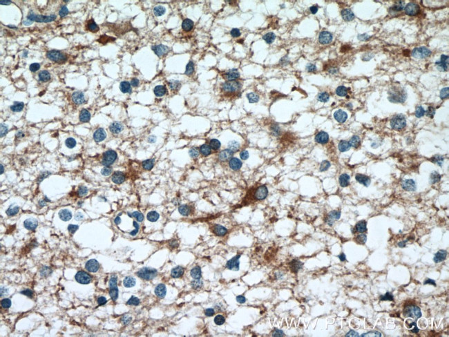 FEZ1 Antibody in Immunohistochemistry (Paraffin) (IHC (P))