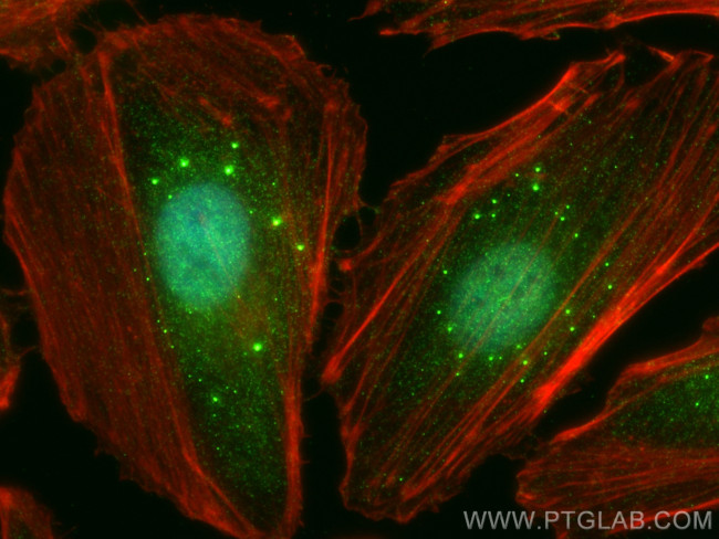 CNBP Antibody in Immunocytochemistry (ICC/IF)